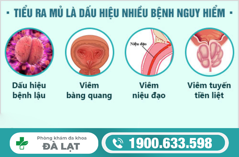 Hình ảnh minh họa